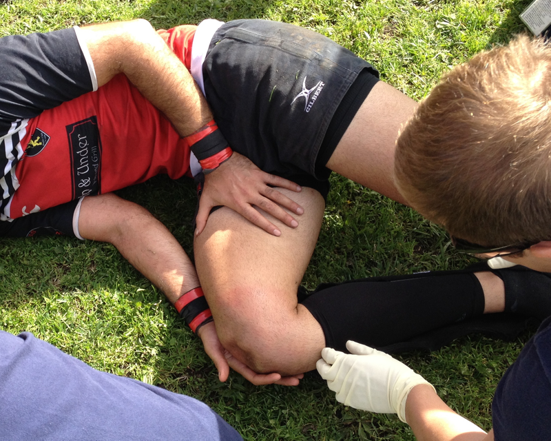 Illustration for article titled Today's Horrific Rugby Injury: Exploded Patella